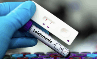 Leishmaniosi