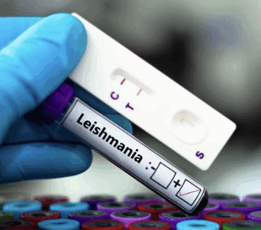 Leishmaniosi